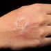 GRIMAS Blarengel - BLISTER GEL 60 ml.